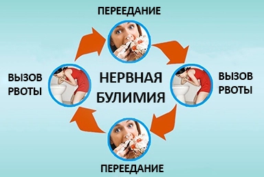 Лечение булимии в Саяногорске